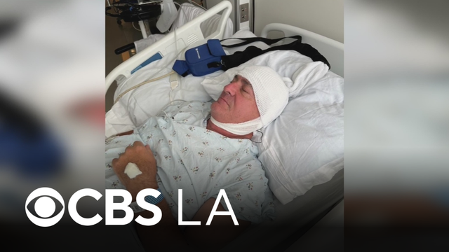 Former CNN correspondent Paul Vercammen recounts near-death experience with West Nile virus