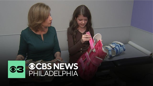 Irish girl travels to Philadephia for specialized scoliosis care: "I've loved every second of it"