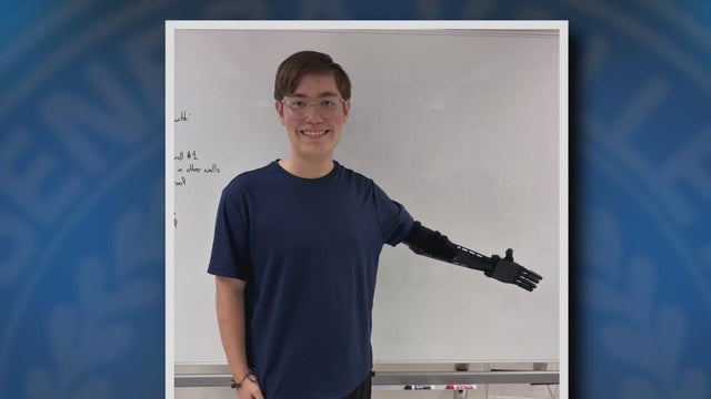 High school student uses 3D printer to change his life